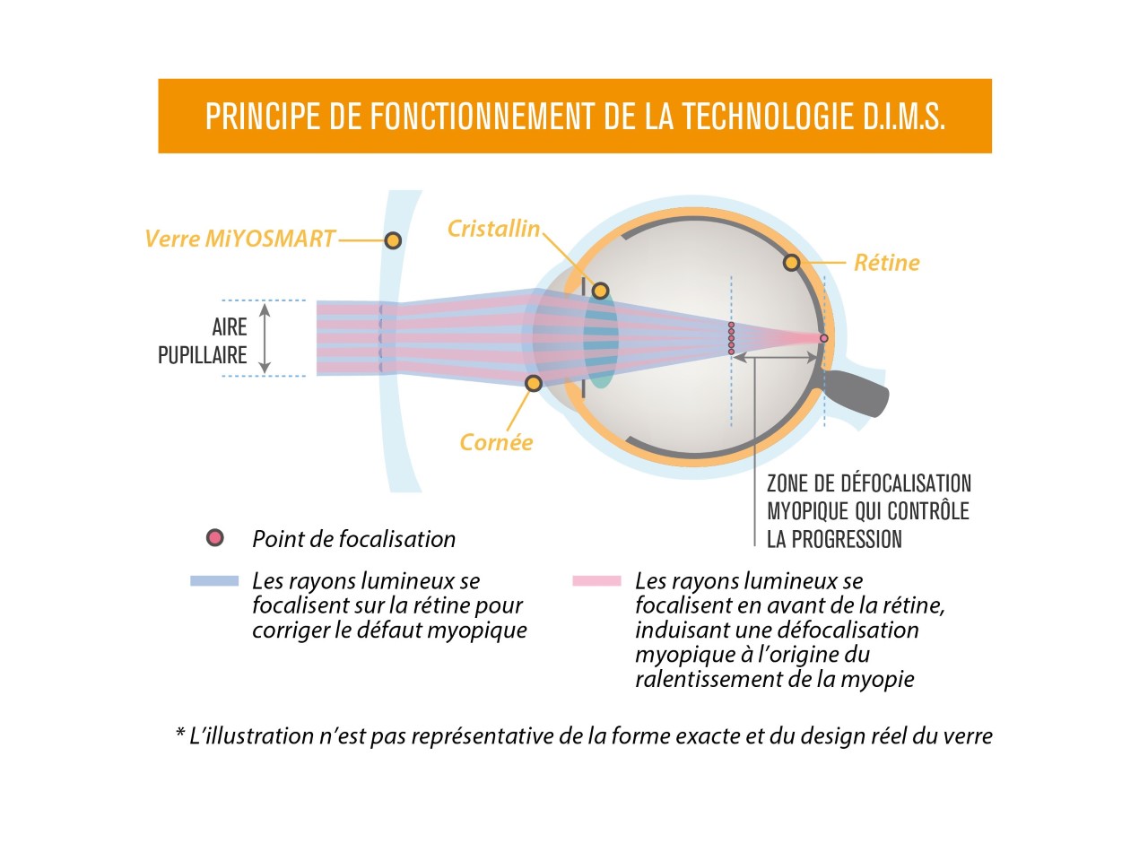 6 conseils pratiques pour que la myopie de votre enfant ne soit